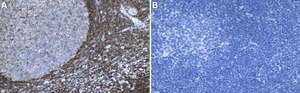 Anti-PKCβ Antibody, clone 2E13 ZooMAb® Rabbit Monoclonal recombinant, expressed in HEK 293 cells