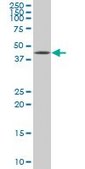 Monoclonal Anti-XBP1 antibody produced in mouse clone 3F5, purified immunoglobulin, buffered aqueous solution