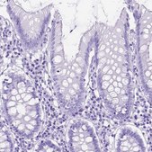 Anti-DNAH2 antibody produced in rabbit Prestige Antibodies® Powered by Atlas Antibodies, affinity isolated antibody, buffered aqueous glycerol solution