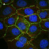 Anti-beta Catenin Antibody, clone 3J7, ZooMAb® Rabbit Monoclonal recombinant, expressed in HEK 293 cells