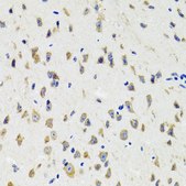 Anti-IKBKG antibody produced in rabbit