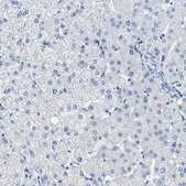 Anti-MYBPC1 antibody produced in rabbit Prestige Antibodies® Powered by Atlas Antibodies, affinity isolated antibody, buffered aqueous glycerol solution