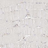 Anti-SYVN1 antibody produced in rabbit Prestige Antibodies® Powered by Atlas Antibodies, affinity isolated antibody, buffered aqueous glycerol solution