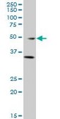 Monoclonal Anti-GATA3 antibody produced in mouse clone 1C1, purified immunoglobulin, buffered aqueous solution