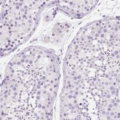 Anti-SSTR4 antibody produced in rabbit Prestige Antibodies® Powered by Atlas Antibodies, affinity isolated antibody, buffered aqueous glycerol solution