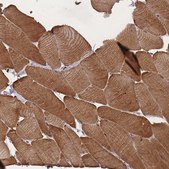 Anti-LDB3 antibody produced in rabbit Prestige Antibodies® Powered by Atlas Antibodies, affinity isolated antibody, buffered aqueous glycerol solution