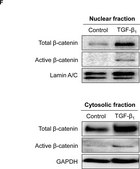 Anti-Active-β-Catenin (Anti-ABC) Antibody, clone 8E7 clone 8E7, Upstate®, from mouse