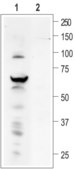 Anti-TRPV4 antibody produced in rabbit affinity isolated antibody, lyophilized powder