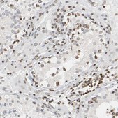 Anti-PRKAG2 antibody produced in rabbit Prestige Antibodies® Powered by Atlas Antibodies, affinity isolated antibody, buffered aqueous glycerol solution