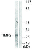 Anti-TIMP2 antibody produced in rabbit affinity isolated antibody