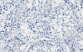 Anti-Ataxin-3 Antibody, clone 2C14 ZooMAb® Rabbit Monoclonal recombinant, expressed in HEK 293 cells
