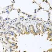 Anti-BAX antibody produced in rabbit