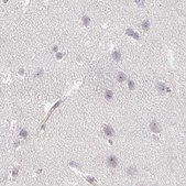 Anti-ACAN antibody produced in rabbit Prestige Antibodies® Powered by Atlas Antibodies, affinity isolated antibody