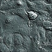 A549 Cells RFP-STAT3