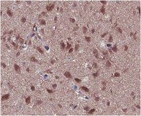 Anti-GABA Antibody from rabbit, purified by affinity chromatography