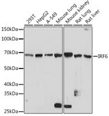 Anti-IRF6 Antibody, clone 5D1Z4, Rabbit Monoclonal