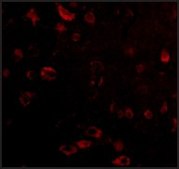 Anti-TIGAR (ab2) antibody produced in rabbit affinity isolated antibody, buffered aqueous solution
