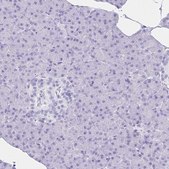 Anti-ATP4B antibody produced in rabbit Prestige Antibodies® Powered by Atlas Antibodies, affinity isolated antibody, buffered aqueous glycerol solution