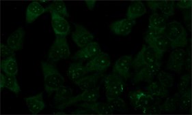 Anti-SUMO 2 兔抗 ~0.6 mg/mL, affinity isolated antibody, buffered aqueous solution