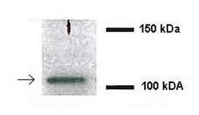 Anti-NEDD4L antibody produced in rabbit affinity isolated antibody