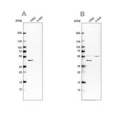 Anti-GLUL antibody produced in rabbit Ab1, Prestige Antibodies® Powered by Atlas Antibodies, affinity isolated antibody, buffered aqueous glycerol solution