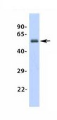 Anti-ADRB1 antibody produced in rabbit affinity isolated antibody