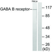 Anti-GABA-B Receptor antibody produced in rabbit affinity isolated antibody