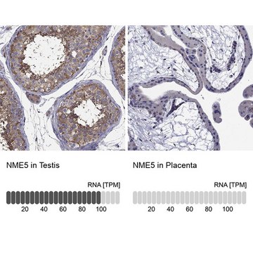 Anti-NME5 antibody produced in rabbit Prestige Antibodies® Powered by Atlas Antibodies, affinity isolated antibody, buffered aqueous glycerol solution