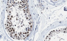 Anti-METTL14 Antibody, clone 2G22 ZooMAb® Rabbit Monoclonal recombinant, expressed in HEK 293 cells