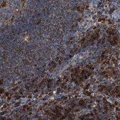 Anti-PTPN1 antibody produced in rabbit Prestige Antibodies® Powered by Atlas Antibodies, affinity isolated antibody, buffered aqueous glycerol solution