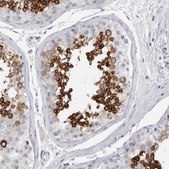 Anti-ADAM2 antibody produced in rabbit Prestige Antibodies® Powered by Atlas Antibodies, affinity isolated antibody, buffered aqueous glycerol solution, Ab2