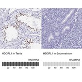 Anti-HDGFL1 antibody produced in rabbit Prestige Antibodies® Powered by Atlas Antibodies, affinity isolated antibody, buffered aqueous glycerol solution