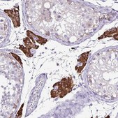 Anti-CYP17A1 antibody produced in rabbit Prestige Antibodies® Powered by Atlas Antibodies, affinity isolated antibody, buffered aqueous glycerol solution