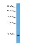 Anti-CXCL12 antibody produced in rabbit affinity isolated antibody
