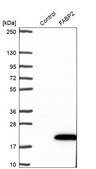 Anti-FABP2 antibody produced in rabbit Prestige Antibodies® Powered by Atlas Antibodies, affinity isolated antibody, buffered aqueous glycerol solution