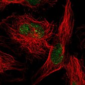 Anti-SUMO2 antibody produced in rabbit Prestige Antibodies® Powered by Atlas Antibodies, affinity isolated antibody, buffered aqueous glycerol solution