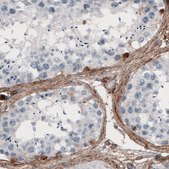 Monoclonal Anti-FN1 antibody produced in mouse Prestige Antibodies® Powered by Atlas Antibodies, clone CL3730, purified immunoglobulin, buffered aqueous glycerol solution