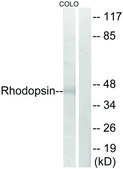 Anti-Rhodopsin antibody produced in rabbit affinity isolated antibody