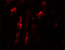 Anti-KANK1 antibody produced in rabbit affinity isolated antibody, buffered aqueous solution