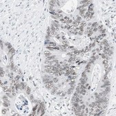 Anti-ARID1A antibody produced in rabbit Prestige Antibodies® Powered by Atlas Antibodies, affinity isolated antibody, buffered aqueous glycerol solution