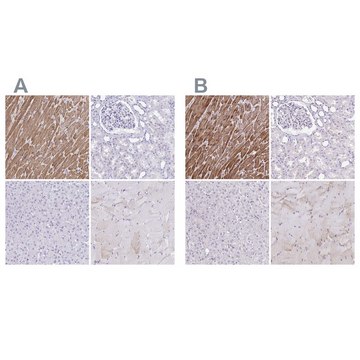 Anti-TNNT2 antibody produced in rabbit Prestige Antibodies® Powered by Atlas Antibodies, affinity isolated antibody, buffered aqueous glycerol solution