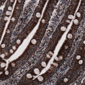 Monoclonal Anti-CS antibody produced in mouse Prestige Antibodies® Powered by Atlas Antibodies, clone CL2561, purified immunoglobulin, buffered aqueous glycerol solution