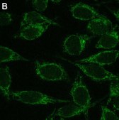 Anti-Mitofusin-2 Antibody, clone 2D19 ZooMAb® Rabbit Monoclonal recombinant, expressed in HEK 293 cells