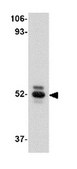 Anti-ASAH1 Antibody from rabbit, purified by affinity chromatography