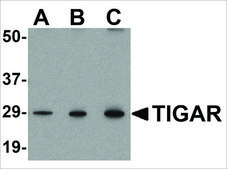 Anti-TIGAR (ab2) antibody produced in rabbit affinity isolated antibody, buffered aqueous solution