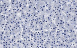 Anti-RORγ Antibody, clone 1D13 ZooMAb® Rabbit Monoclonal recombinant, expressed in HEK 293 cells