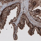 Monoclonal Anti-EZR antibody produced in mouse Prestige Antibodies® Powered by Atlas Antibodies, clone CL2378, purified immunoglobulin, buffered aqueous glycerol solution