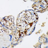 Anti-Fibrinogen alpha chain (FGA) antibody produced in rabbit
