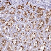 Anti-ATP4B antibody produced in rabbit Prestige Antibodies® Powered by Atlas Antibodies, affinity isolated antibody, buffered aqueous glycerol solution