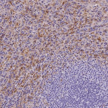 Anti-SLC40A1 antibody produced in rabbit Prestige Antibodies® Powered by Atlas Antibodies, affinity isolated antibody, buffered aqueous glycerol solution